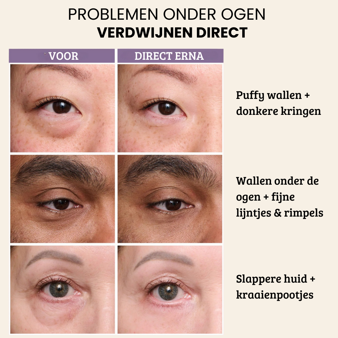 FirmX Easy-Wear Anti-Rimpel Oogcreme