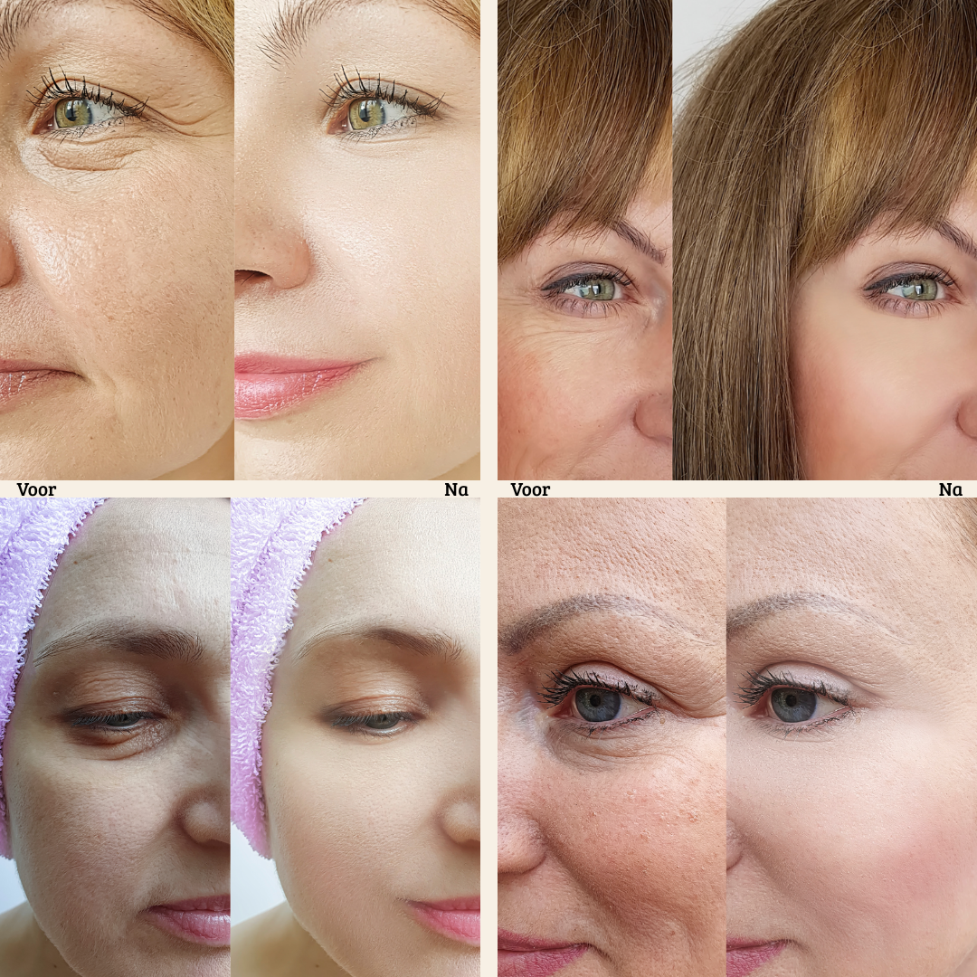 FirmX Easy-Wear Anti-Rimpel Oogcreme