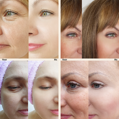 FirmX Easy-Wear Anti-Rimpel Oogcreme